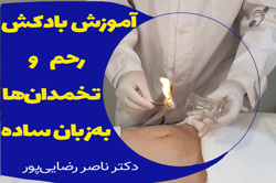 آموزش ساده بادکش رحم و تخمدانها در منزل توسط متخصص طب ایرانی